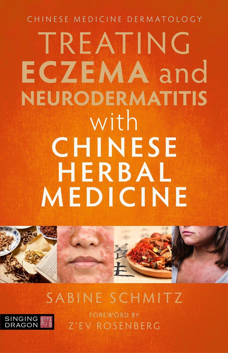 Cover: 9781787752306 | Treating Eczema and Neurodermatitis with Chinese Herbal Medicine