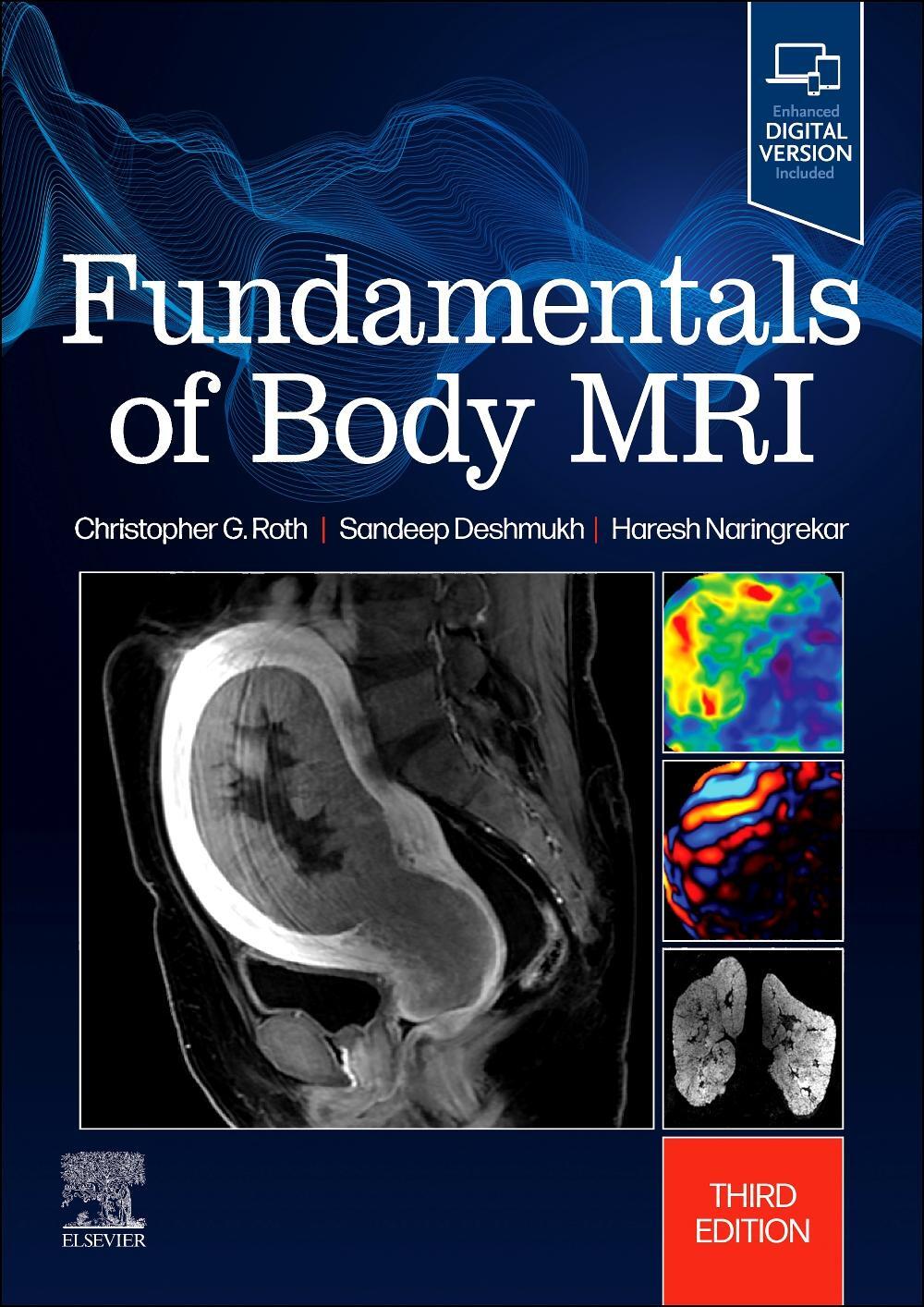 Cover: 9780323833813 | Fundamentals of Body MRI | Christopher G Roth (u. a.) | Taschenbuch