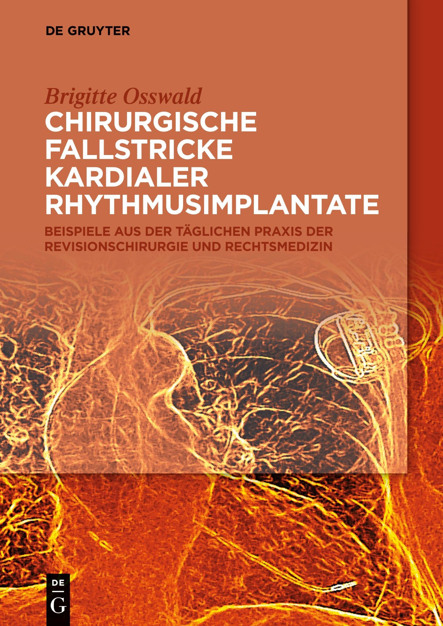 Cover: 9783110636963 | Chirurgische Fallstricke kardialer Rhythmusimplantate | Osswald | Buch