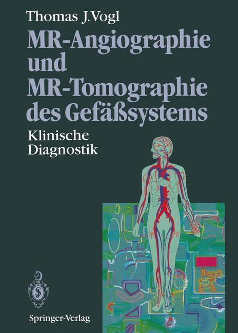 Cover: 9783642789816 | MR-Angiographie und MR-Tomographie des Gefäßsystems | Thomas J. Vogl