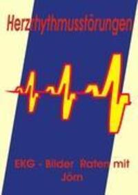 Cover: 9783837042535 | Herzrhythmusstörungen | EKG - Bilder Raten mit Jörn | Jörn Nickoleit