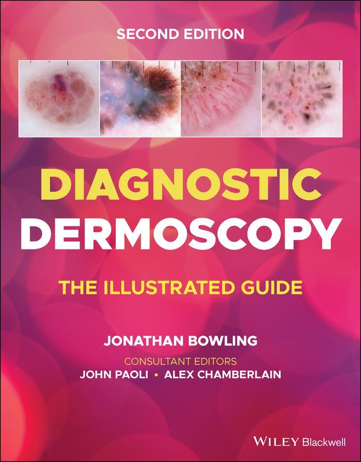 Cover: 9781118930489 | Diagnostic Dermoscopy | The Illustrated Guide | Bowling (u. a.) | Buch