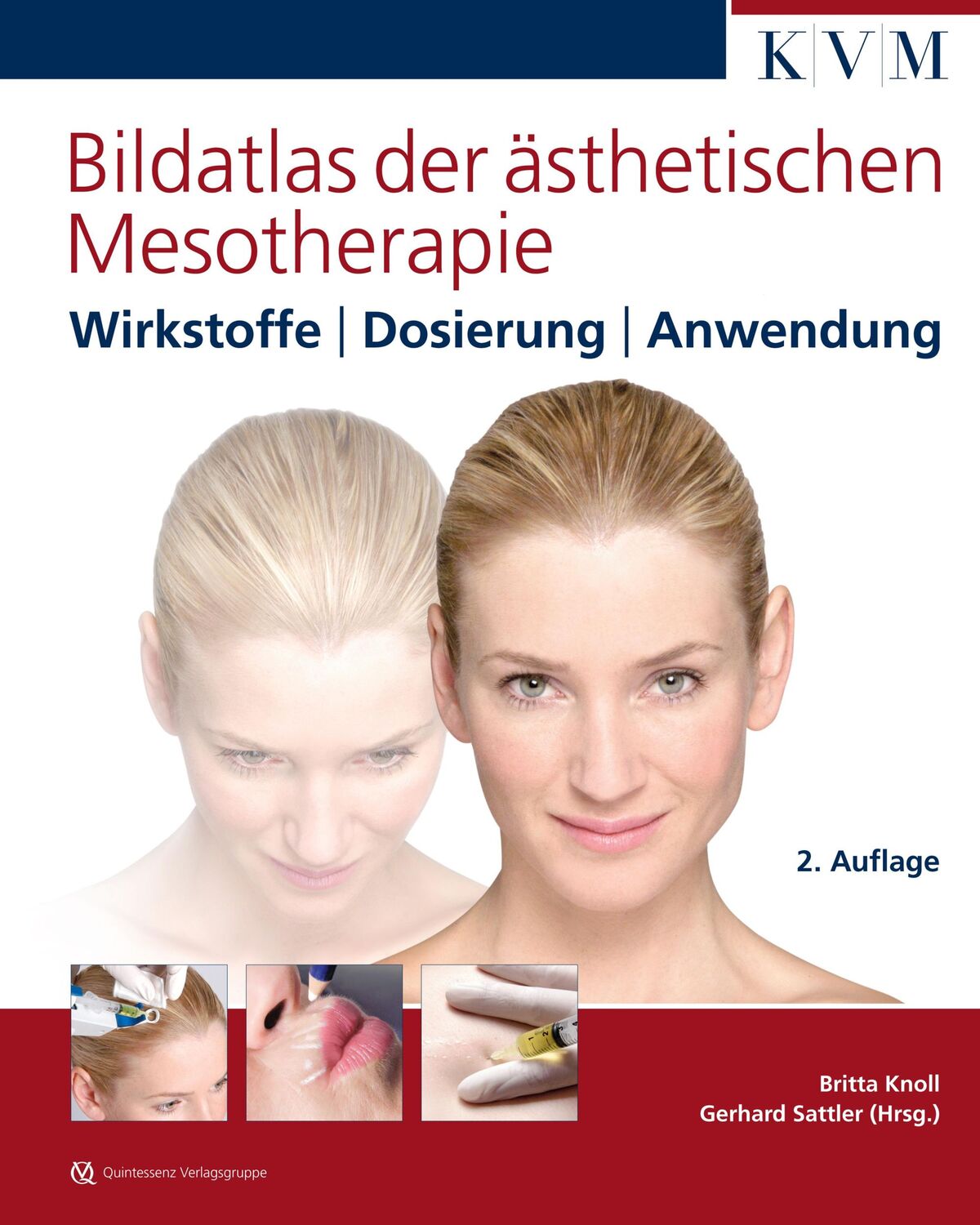 Cover: 9783868673296 | Bildatlas der ästhetischen Mesotherapie | Britta Knoll | Buch | 230 S.