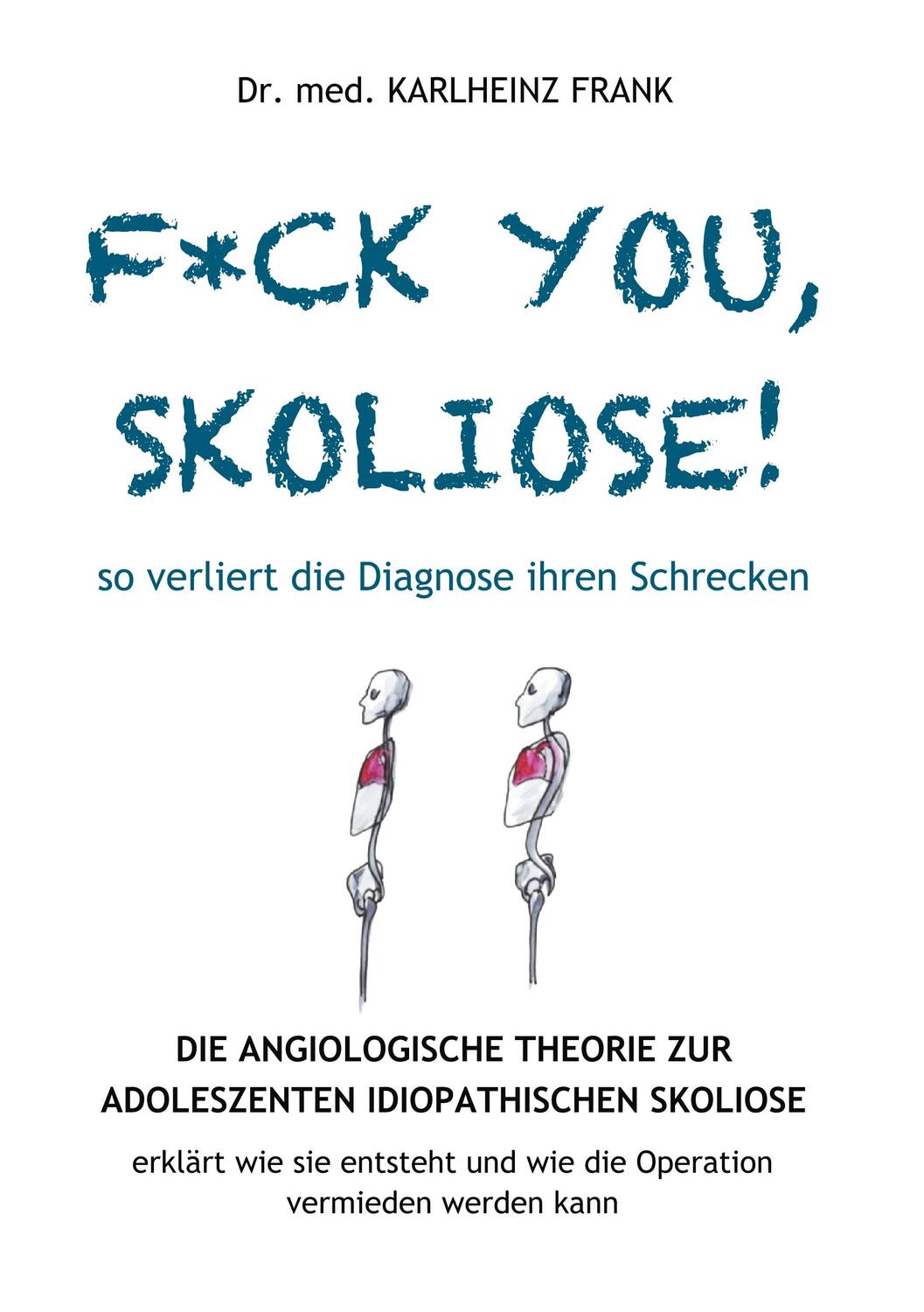 Cover: 9783750441125 | F*ck you, Skoliose! So verliert die Diagnose ihren Schrecken | Frank