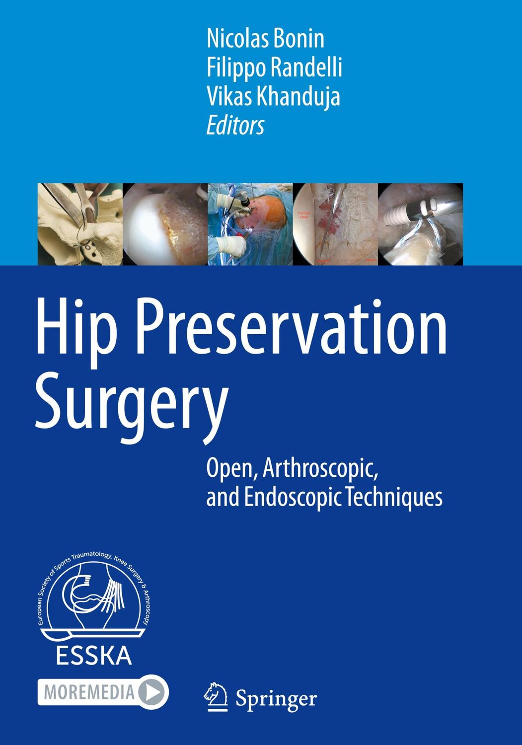 Cover: 9783662611852 | Hip Preservation Surgery | Nicolas Bonin (u. a.) | Buch | xiv | 2020