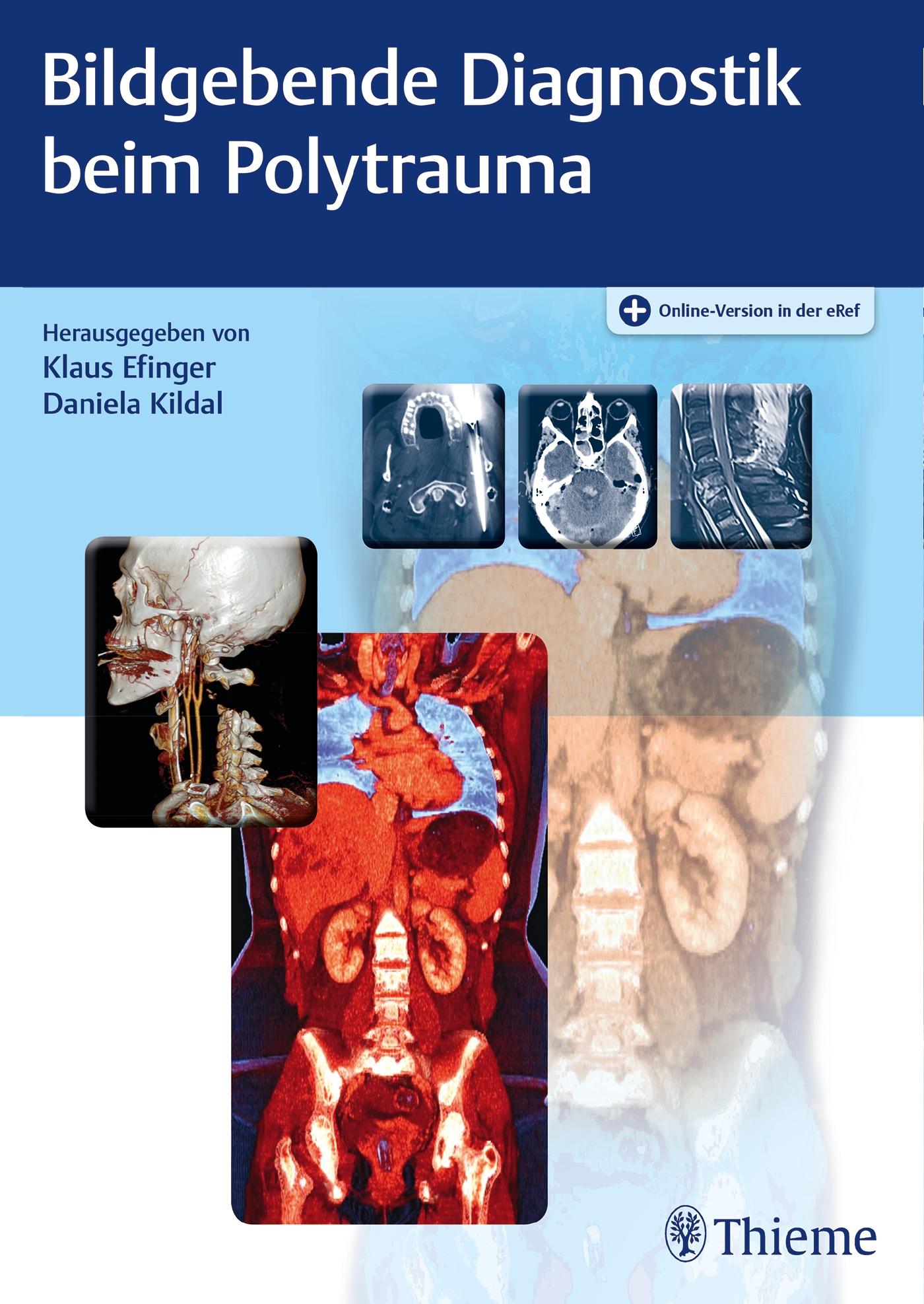 Cover: 9783132007819 | Bildgebende Diagnostik beim Polytrauma | Klaus Efinger (u. a.) | 2019