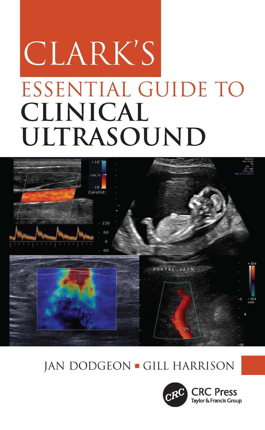 Cover: 9780367775087 | Clark's Essential Guide to Clinical Ultrasound | Gill Harrison (u. a.)