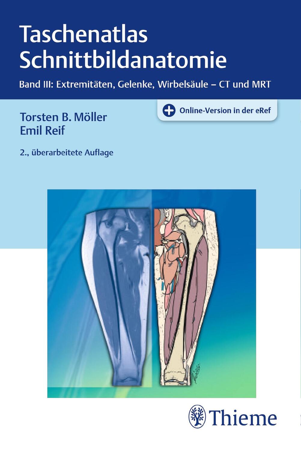 Cover: 9783131392626 | Taschenatlas Schnittbildanatomie 03 | Torsten Bert Möller (u. a.)