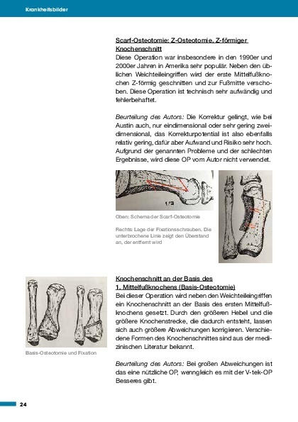 Bild: 9783966641999 | Medizin in Fakten: Gesunder Fuß | Michael Vitek | Taschenbuch | 128 S.