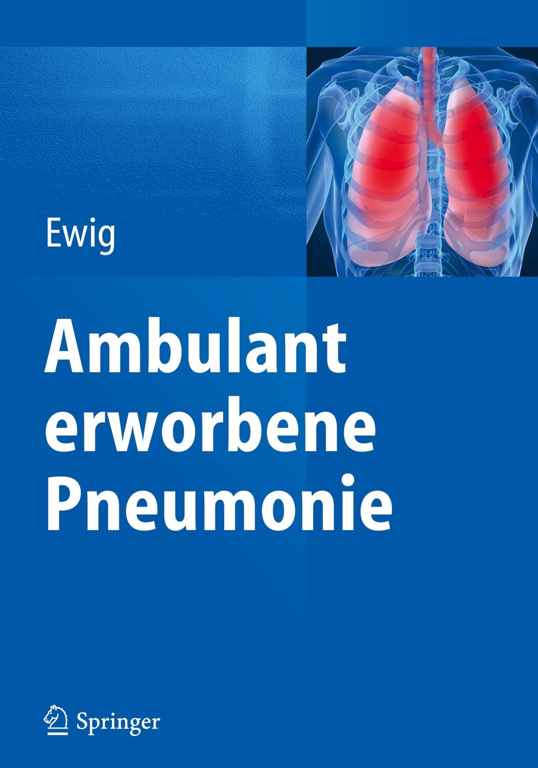 Cover: 9783662473115 | Ambulant erworbene Pneumonie | Santiago Ewig | Buch | ix | Deutsch