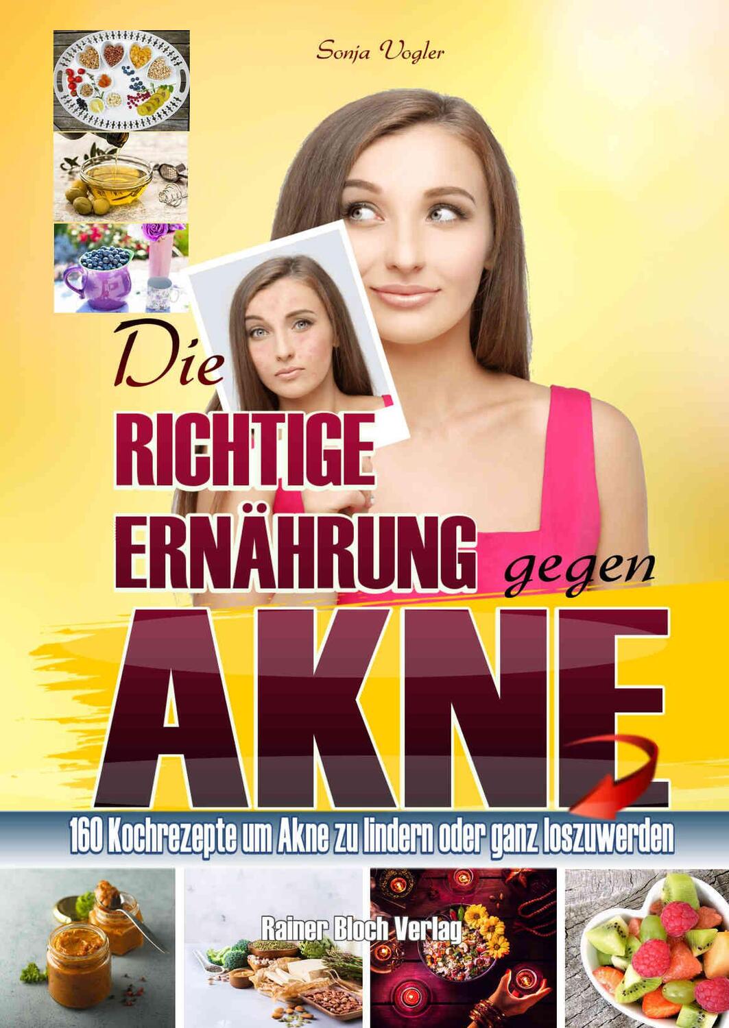 Cover: 9783982224534 | Die richtige Ernährung gegen Akne | Sonja Vogler | Taschenbuch | 2020