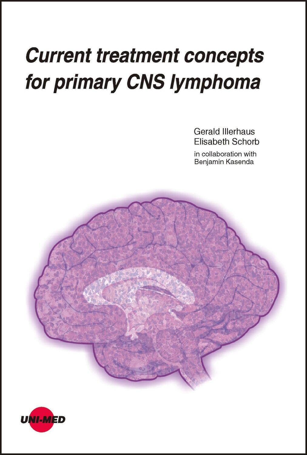 Cover: 9783837424201 | Current treatment concepts for primary CNS lymphoma | Buch | 80 S.