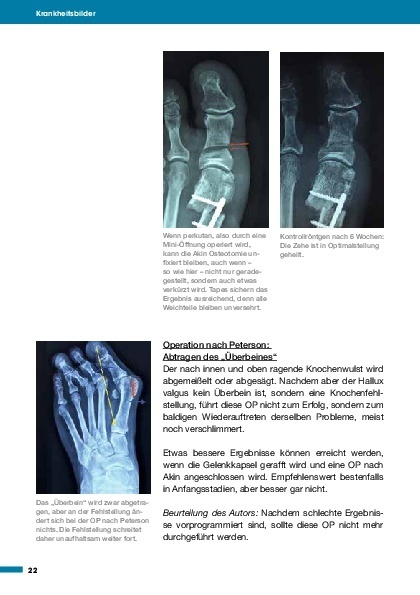 Bild: 9783966641999 | Medizin in Fakten: Gesunder Fuß | Michael Vitek | Taschenbuch | 128 S.