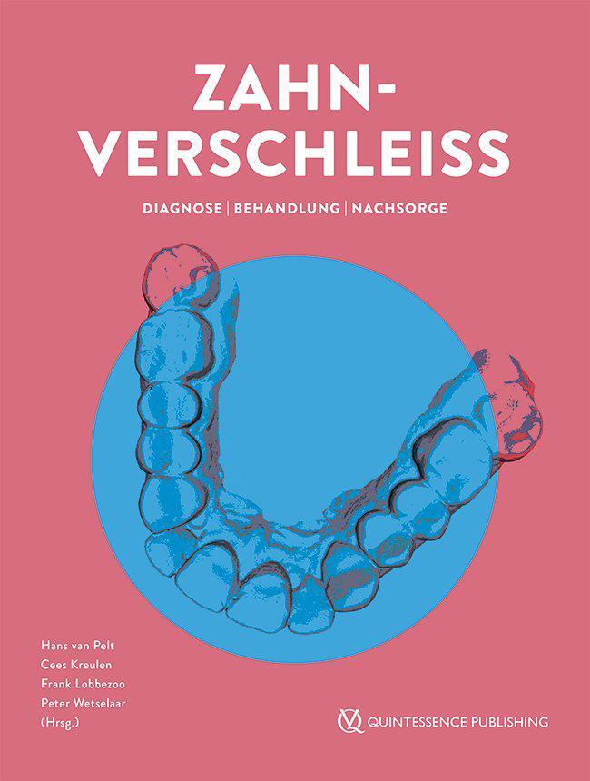 Cover: 9783868676075 | Zahnverschleiß | Diagnose, Behandlung und Prognose | Pelt (u. a.)