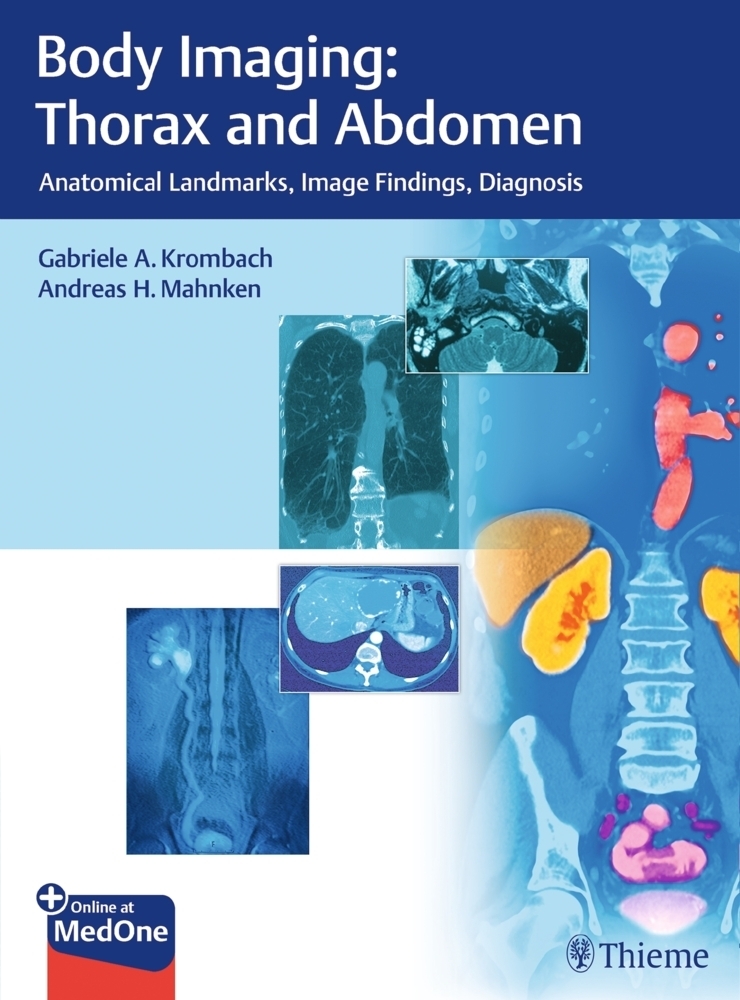 Cover: 9783132054110 | Body Imaging: Thorax and Abdomen | Gabriele A. Krombach (u. a.) | 2018