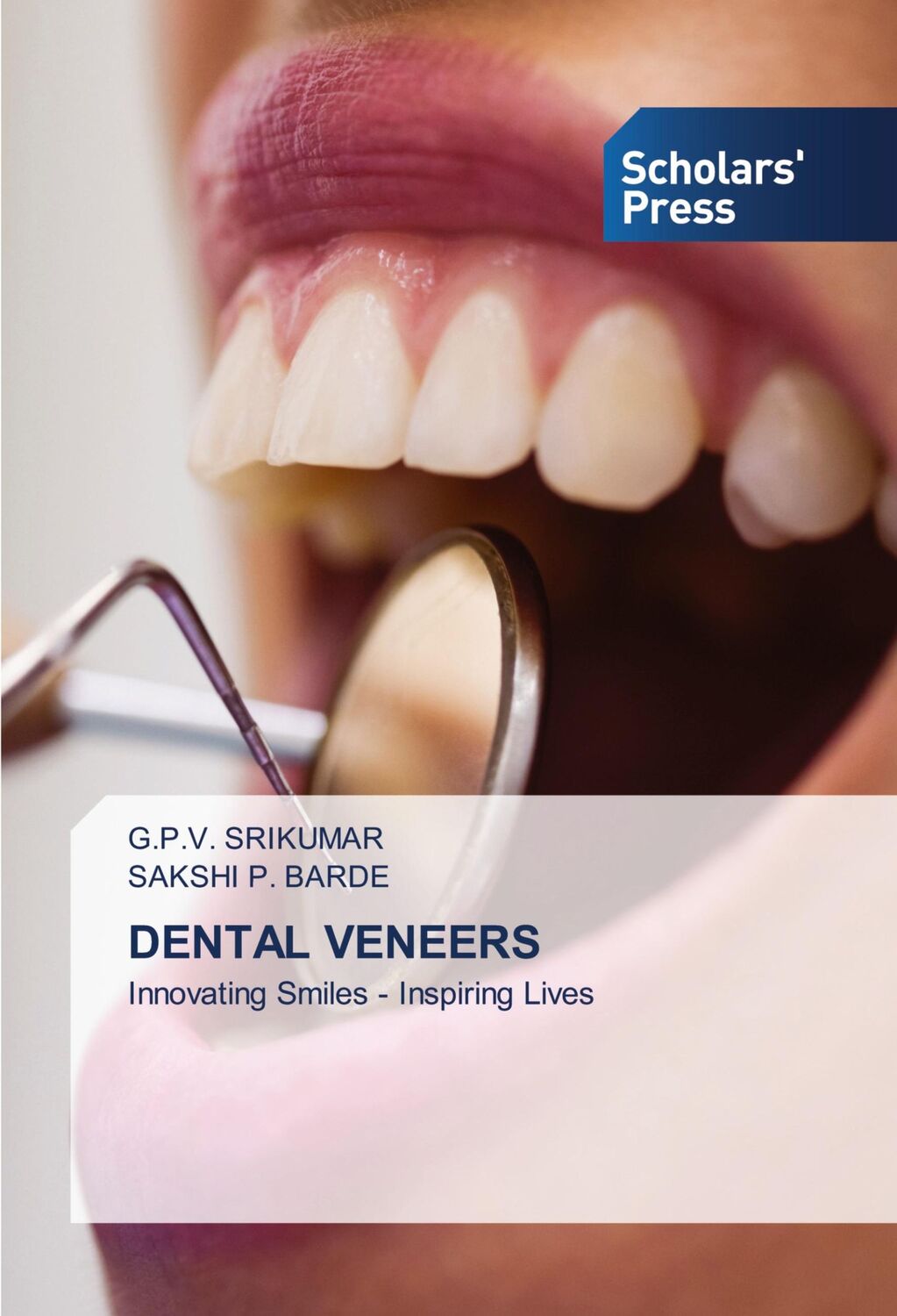 Cover: 9786206773993 | DENTAL VENEERS | Innovating Smiles - Inspiring Lives | Taschenbuch