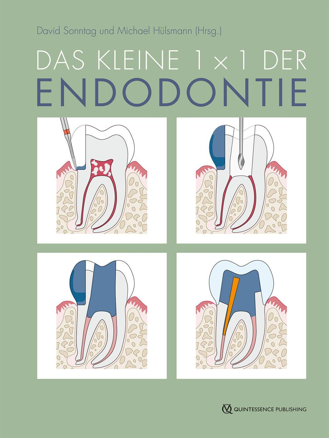 Cover: 9783868676112 | Das kleine 1x1 der Endodontie | David Sonntag (u. a.) | Buch | 350 S.