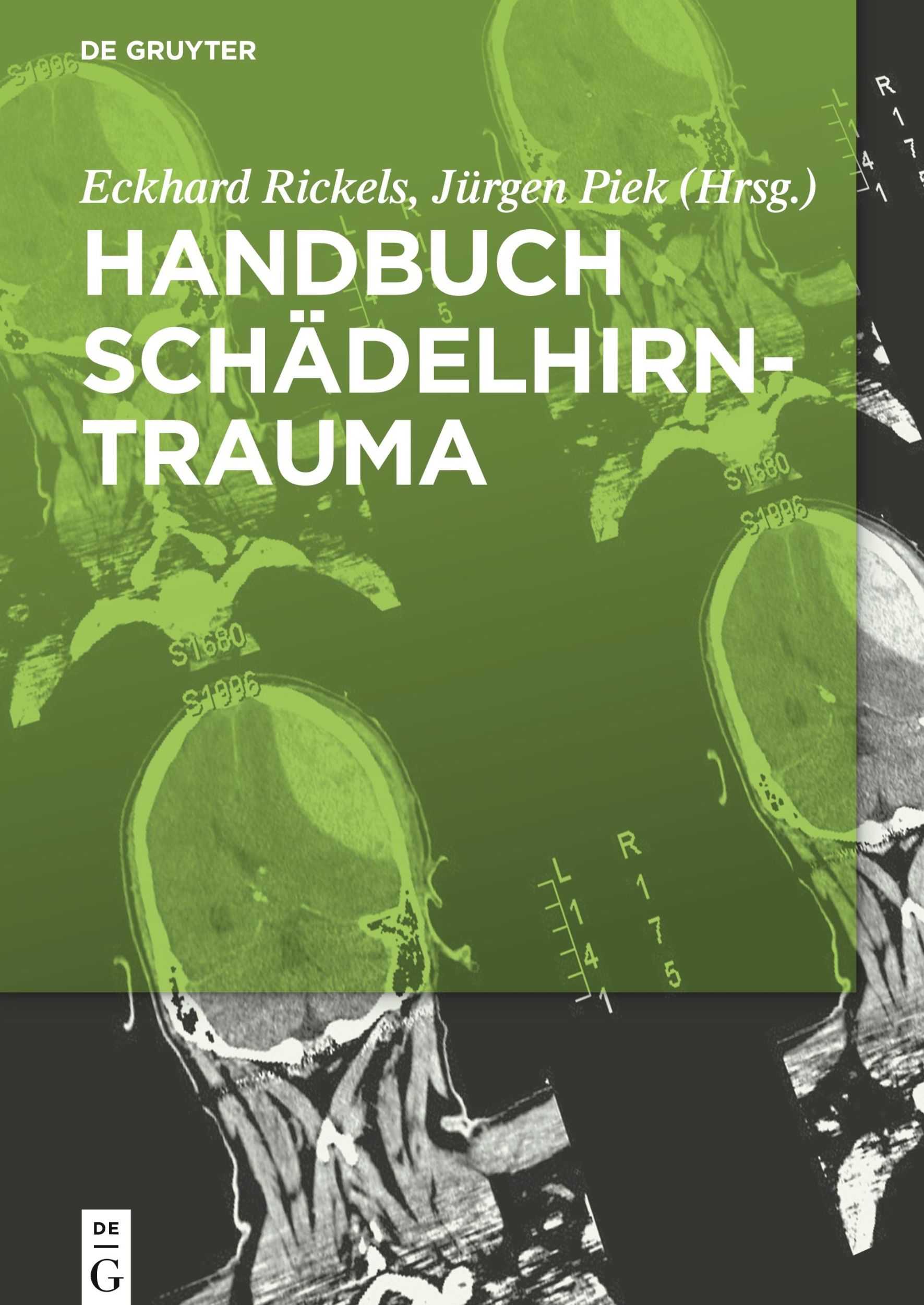 Cover: 9783110372342 | Handbuch Schädelhirntrauma | Jürgen Piek (u. a.) | Buch | XVIII | 2018