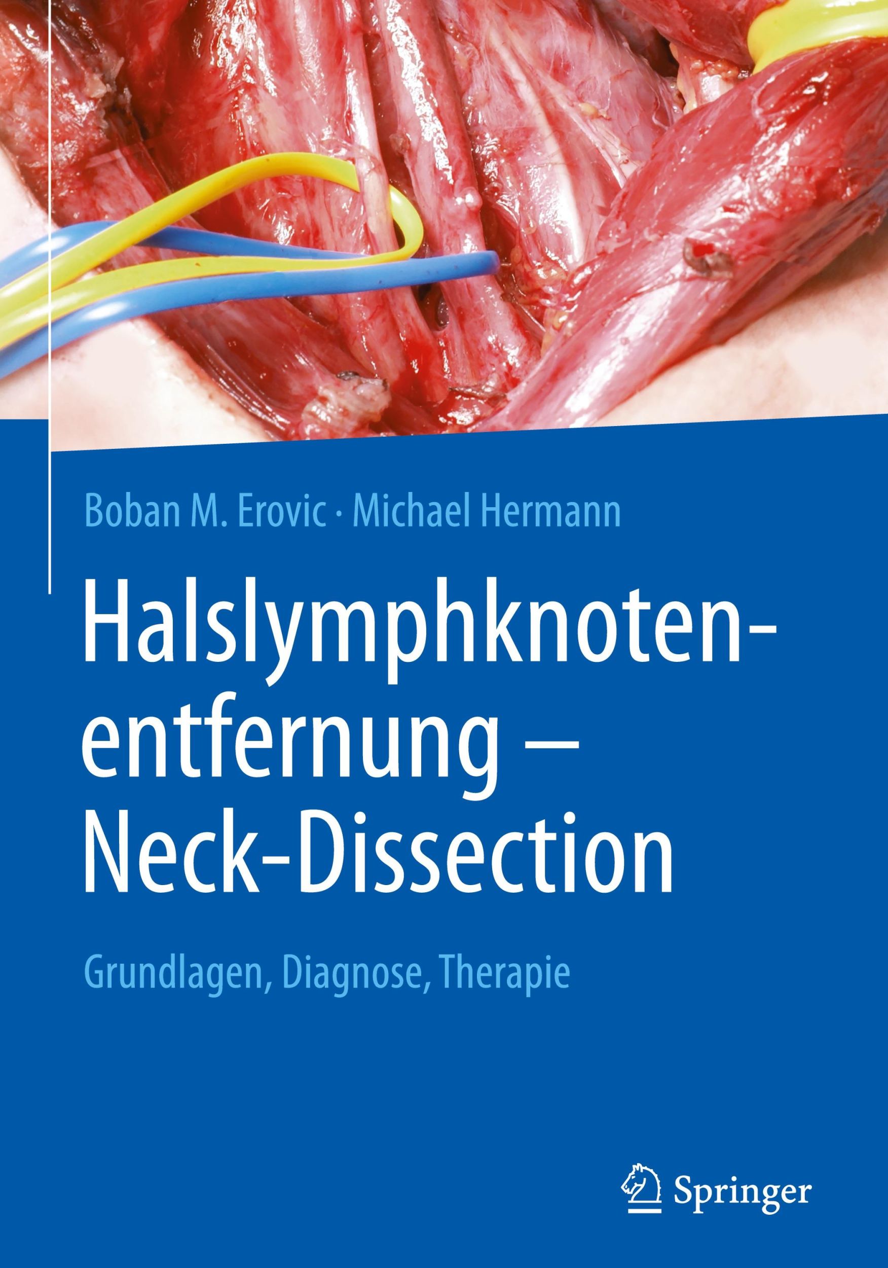 Cover: 9783662625651 | Halslymphknotenentfernung - Neck-Dissection | Michael Hermann (u. a.)