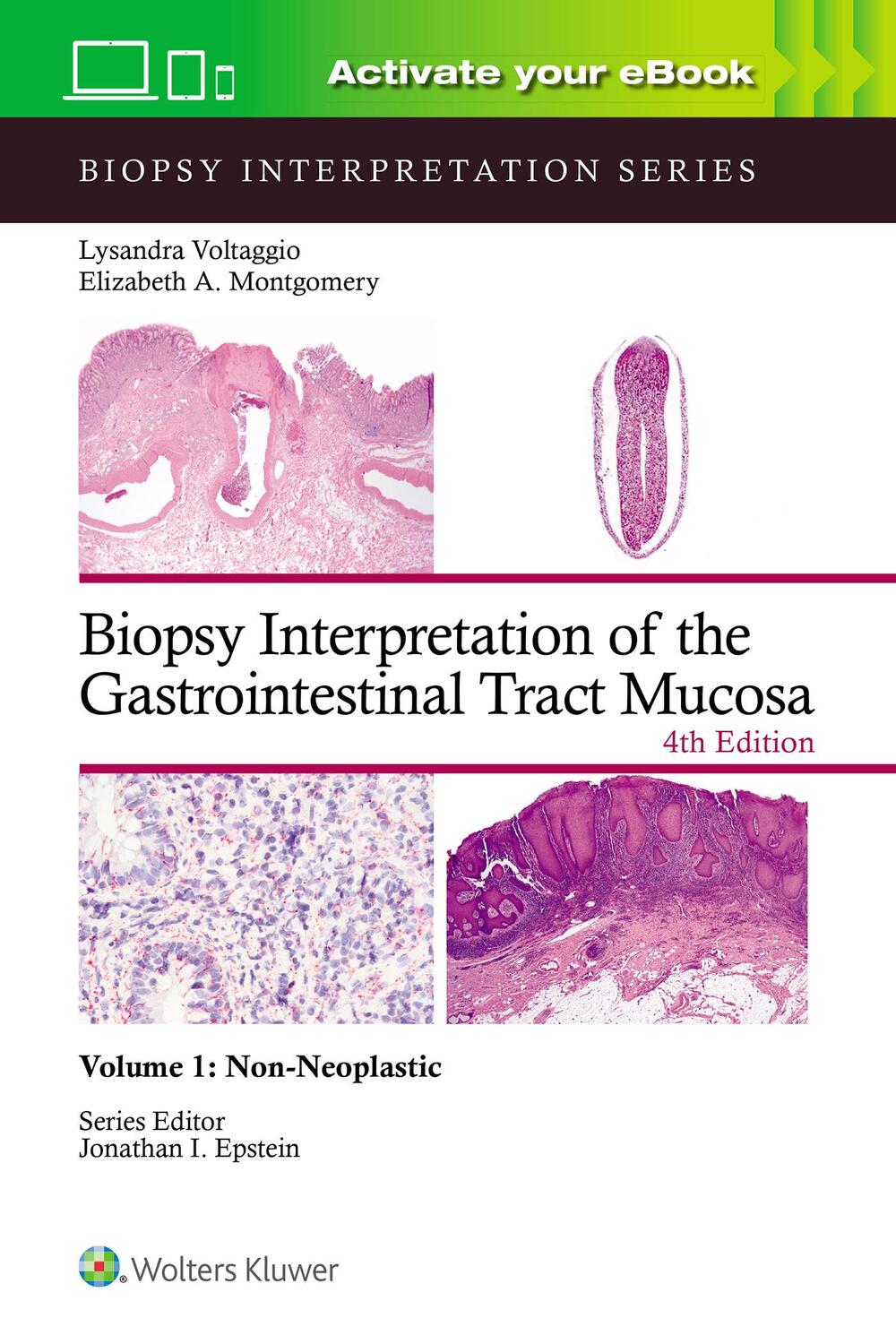 Cover: 9781975213664 | Biopsy Interpretation of the Gastrointestinal Tract Mucosa Volume 1