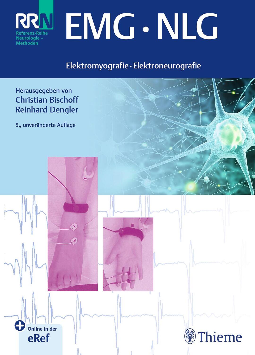 Cover: 9783132458024 | EMG NLG | Elektromyografie · Elektroneurografie | Bischoff (u. a.)