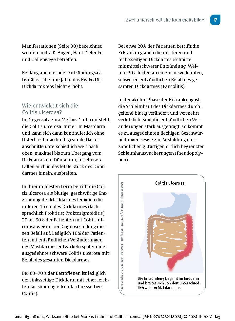 Bild: 9783432118024 | Wirksame Hilfe bei Morbus Crohn und Colitis ulcerosa | Dignaß (u. a.)