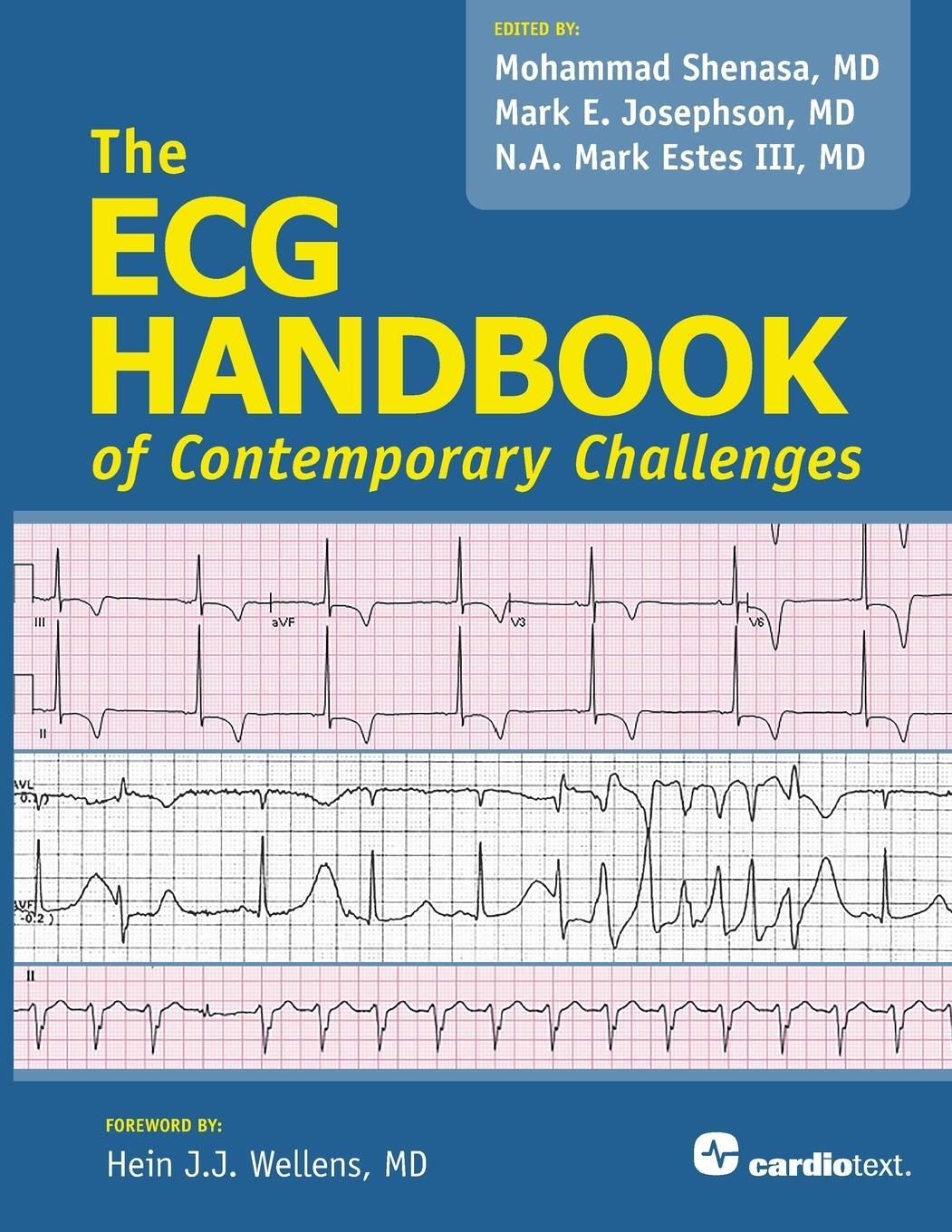 Cover: 9781935395881 | The ECG Handbook of Contemporary Challenges | Mohammad Shenasa | Buch