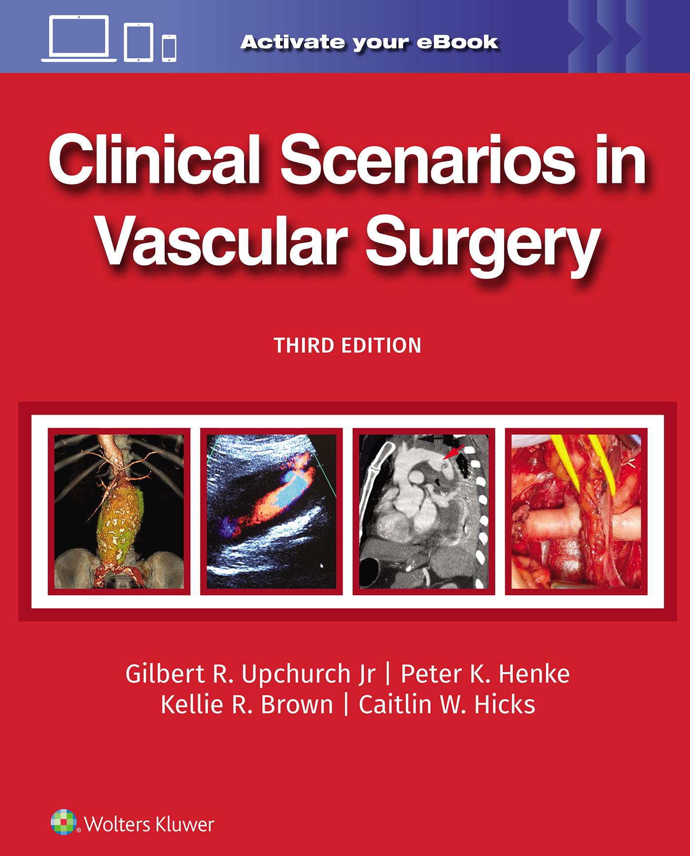 Cover: 9781975216238 | Clinical Scenarios in Vascular Surgery | Caitlin Whitney Hicks (u. a.)