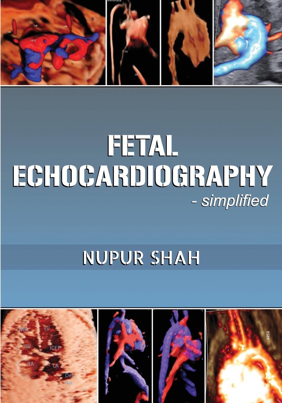 Cover: 9781636408484 | Fetal Echocardiography - Simplified | Nupur Shah | Taschenbuch | 2023