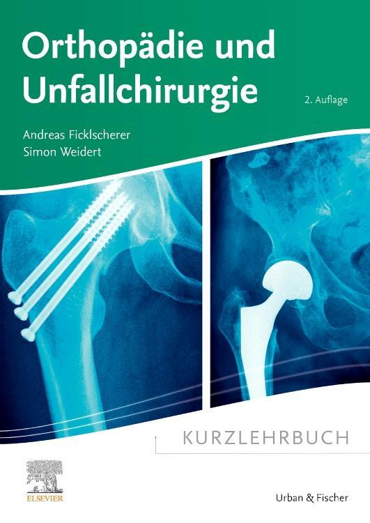 Cover: 9783437411892 | Kurzlehrbuch Orthopädie und Unfallchirurgie | Ficklscherer (u. a.)