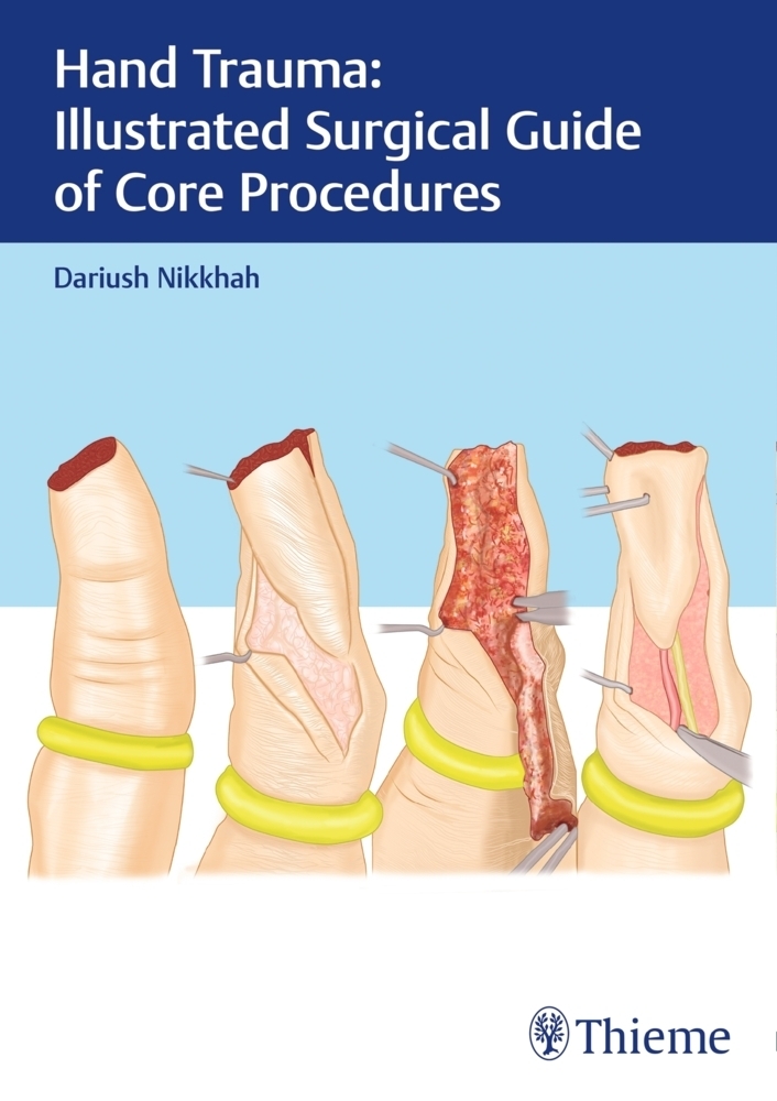 Cover: 9783132414266 | Hand Trauma: Illustrated Surgical Guide of Core Procedures | Nikkhah