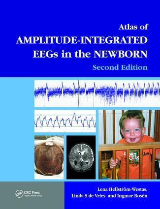 Cover: 9781841846491 | An Atlas of Amplitude-Integrated EEGs in the Newborn | Rosen (u. a.)