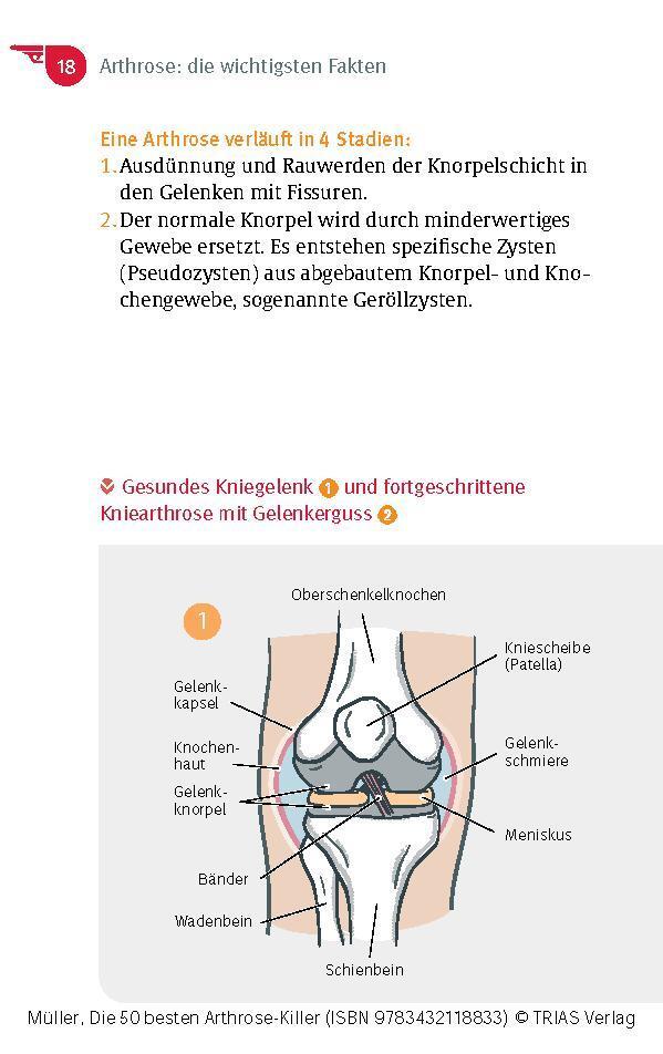 Bild: 9783432118833 | Die 50 besten Arthrose-Killer | Sven-David Müller | Taschenbuch | 2024