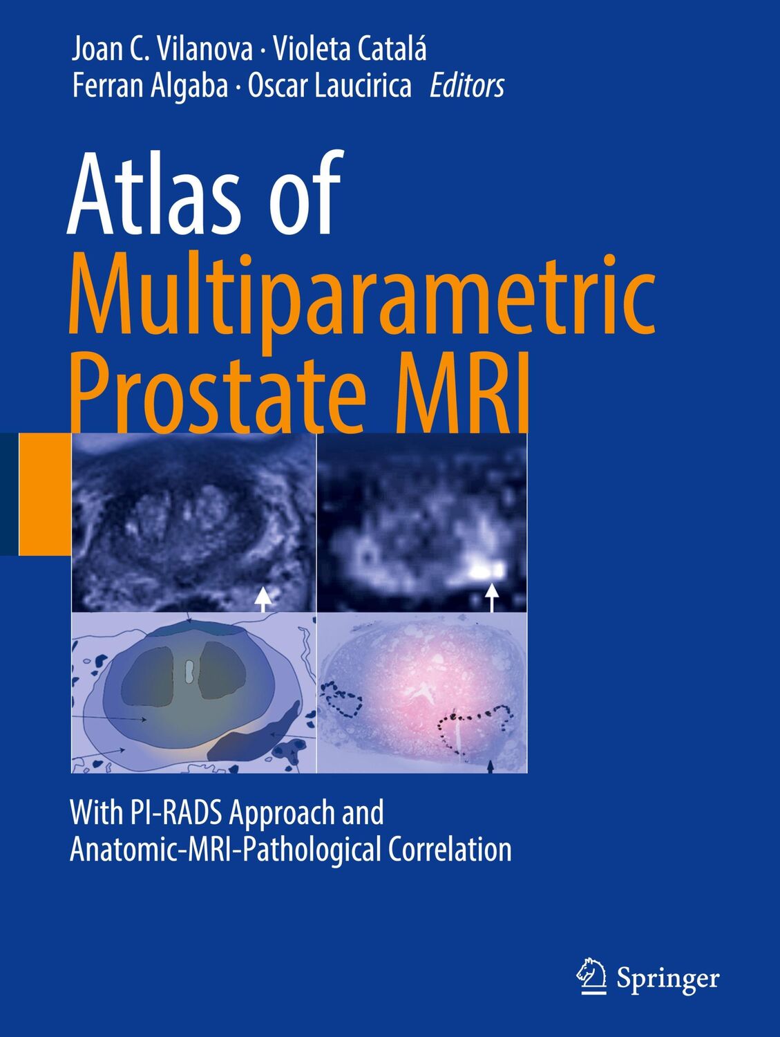 Cover: 9783319617855 | Atlas of Multiparametric Prostate MRI | Joan C. Vilanova (u. a.) | xi