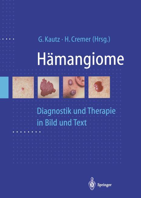 Cover: 9783642803482 | Hämangiome | Diagnostik und Therapie in Bild und Text | Cremer (u. a.)