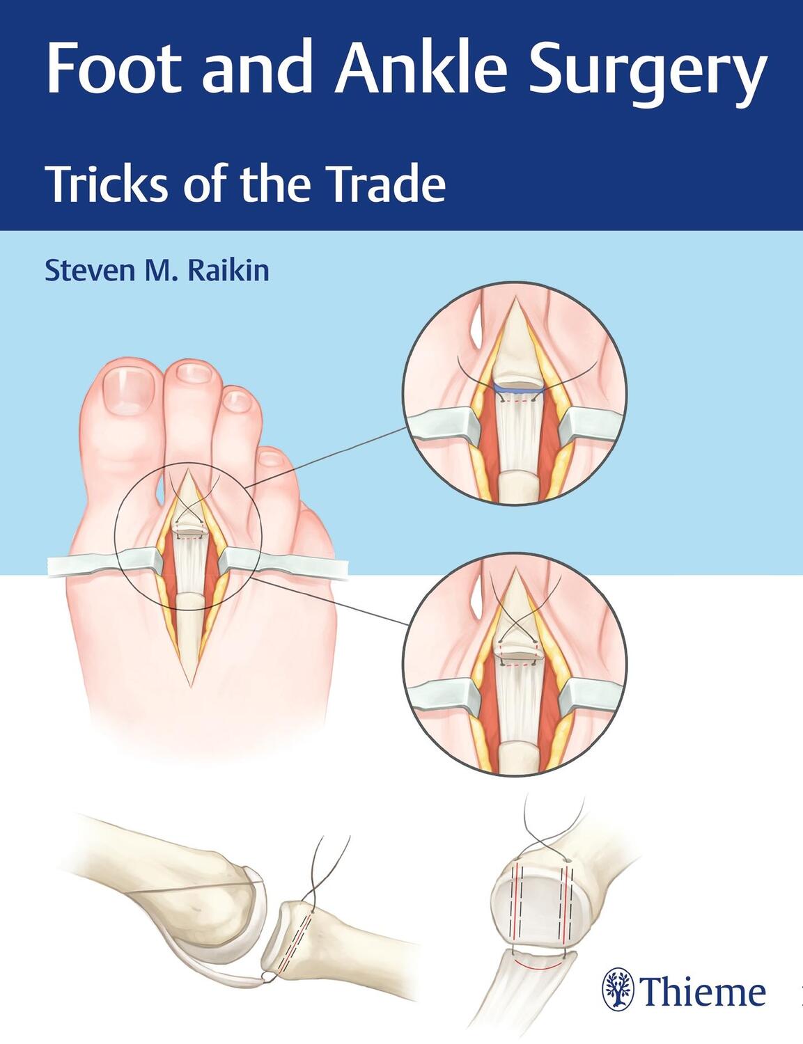 Cover: 9781626234918 | Foot and Ankle Surgery | Tricks of the Trade | Steven M Raikin | Buch