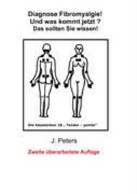 Cover: 9783837092387 | Diagnose Fibromyalgie! Und was kommt jetzt? | Das sollten sie Wissen!