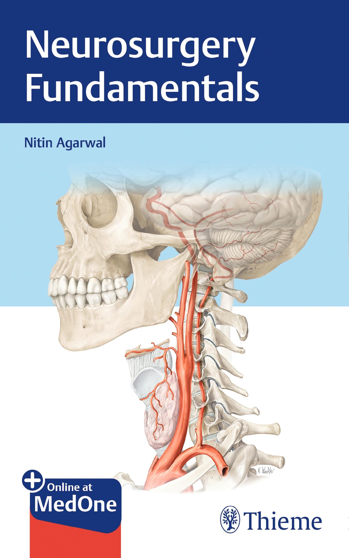 Cover: 9781626238220 | Neurosurgery Fundamentals | Nitin Agarwal | Bundle | 1 Taschenbuch