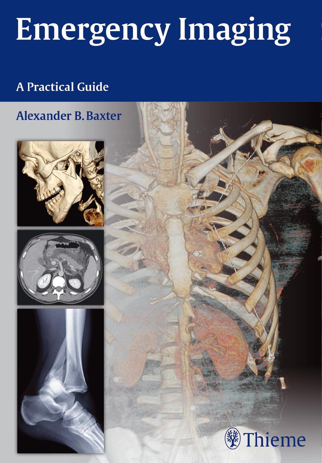 Cover: 9781604067422 | Emergency Imaging | Alexander Baxter | Taschenbuch | 564 S. | Englisch