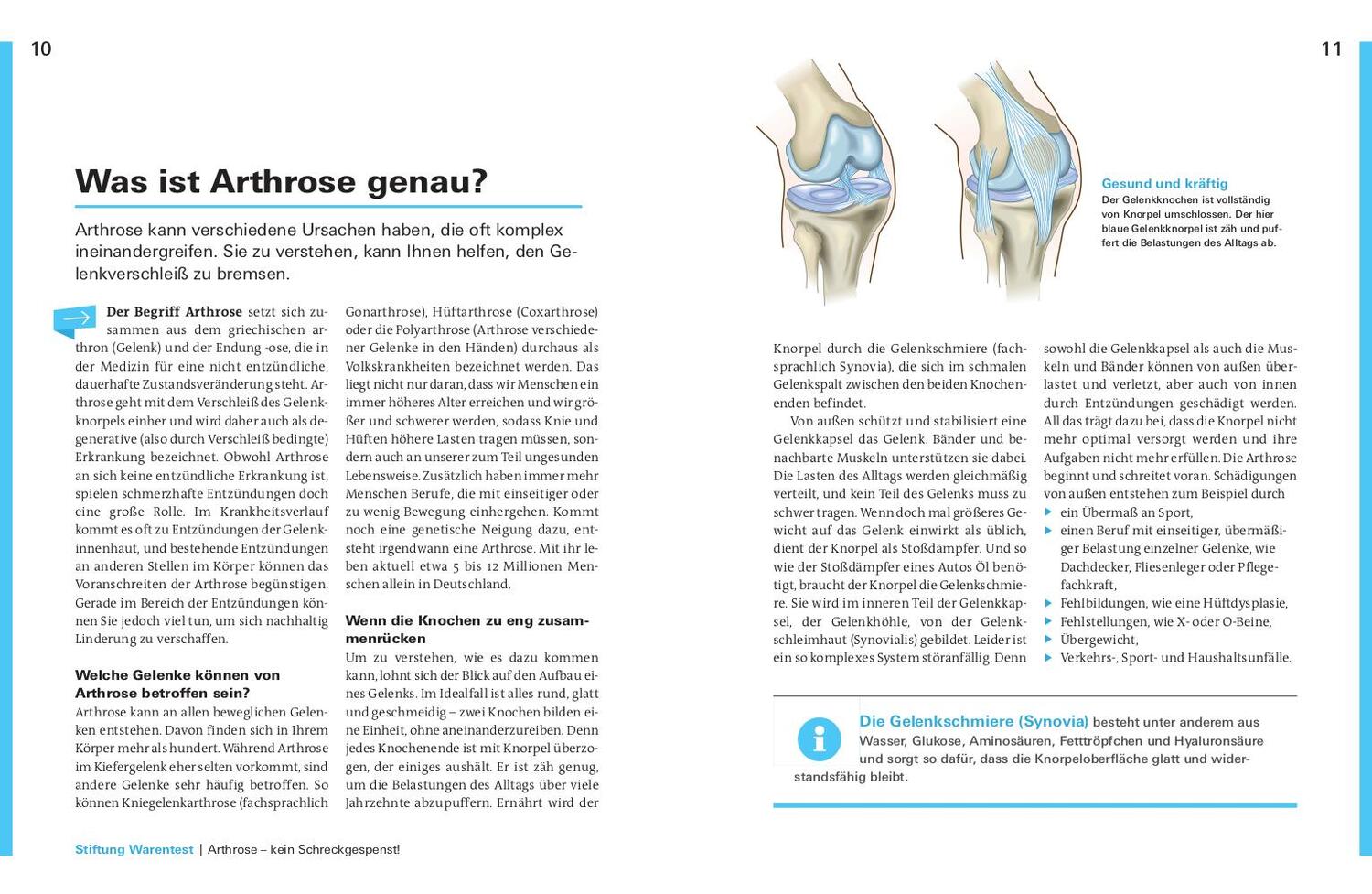 Bild: 9783747103340 | Aktiv leben mit Arthrose | Das Endlich-schmerzfrei-Buch | Taschenbuch