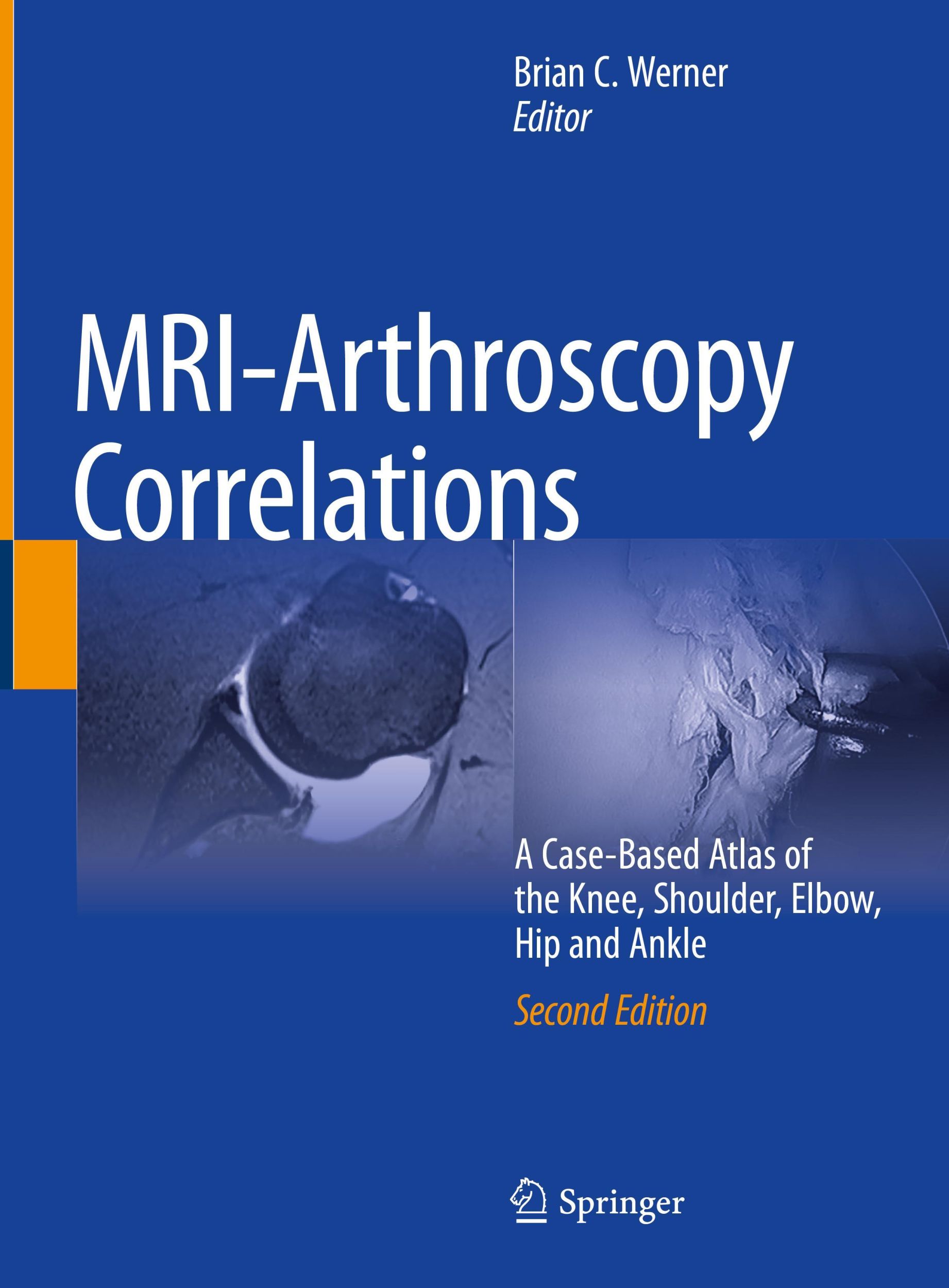 Cover: 9783030947880 | MRI-Arthroscopy Correlations | Brian C. Werner | Buch | xviii | 2022