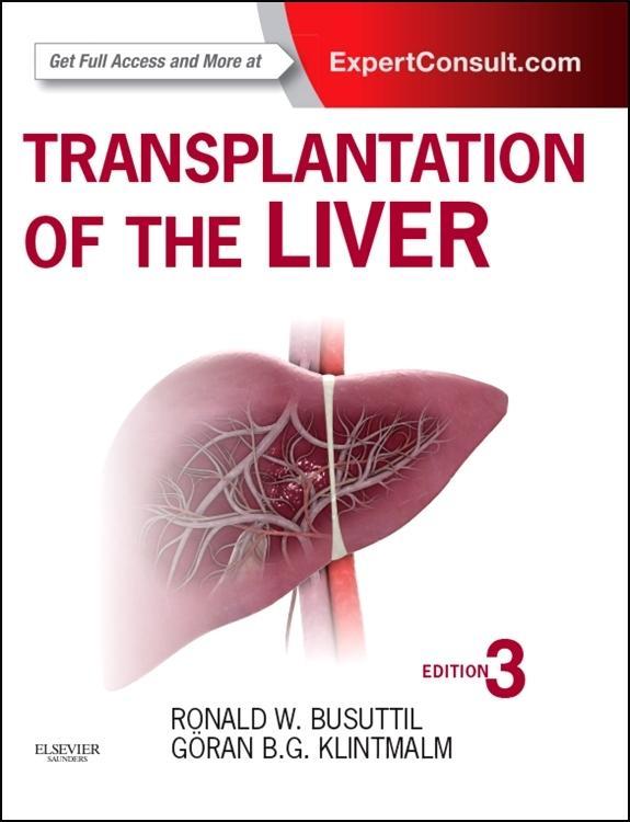 Cover: 9781455702688 | Transplantation of the Liver | Expert Consult - Online and Print