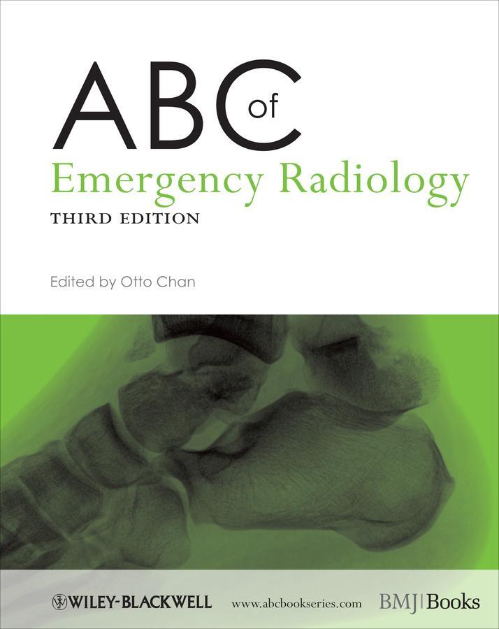 Cover: 9780470670934 | ABC of Emergency Radiology | Otto Chan | Taschenbuch | 194 S. | 2013