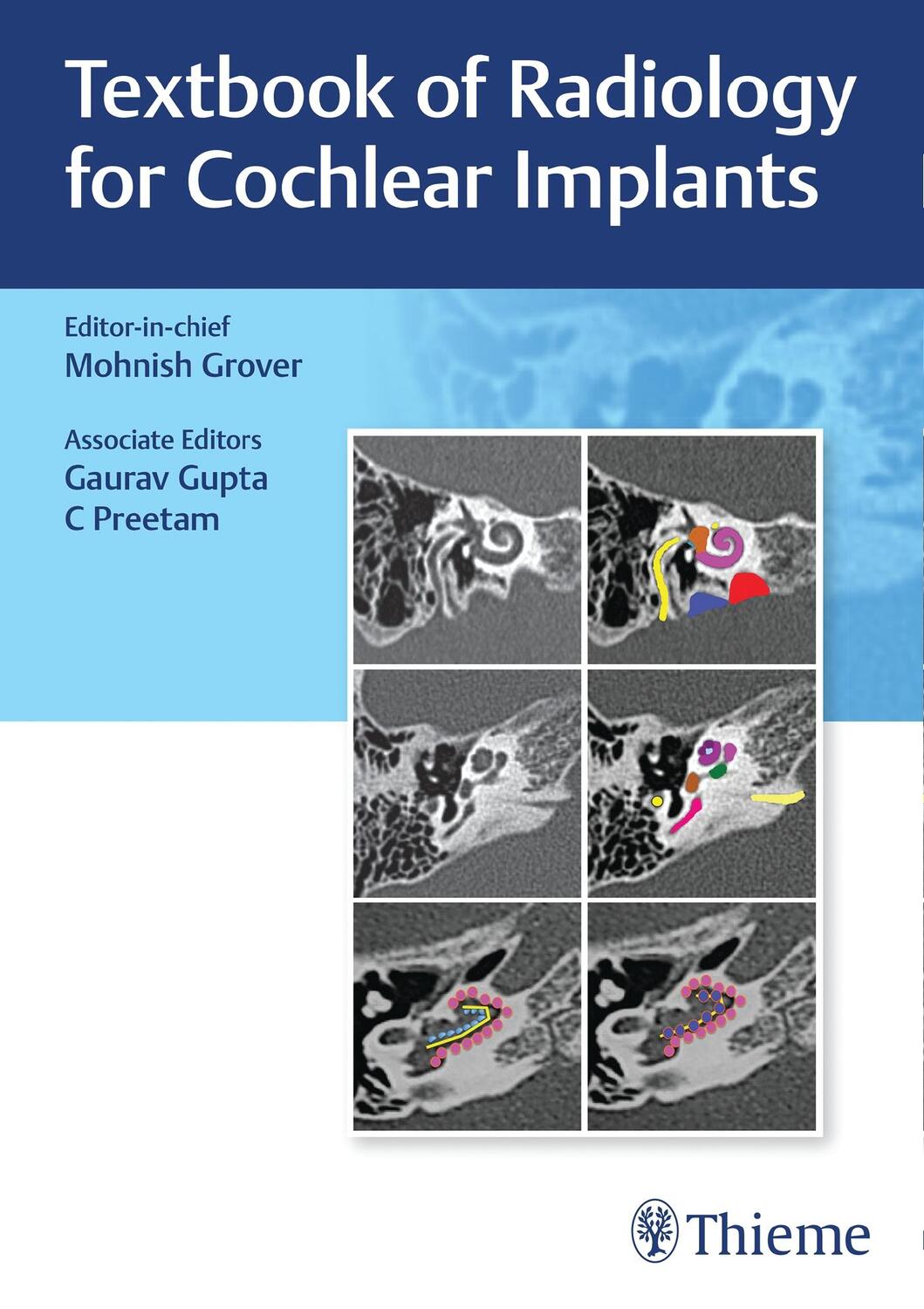 Cover: 9789392819261 | Textbook of Radiology for Cochlear Implants | Mohnish Grover | Buch