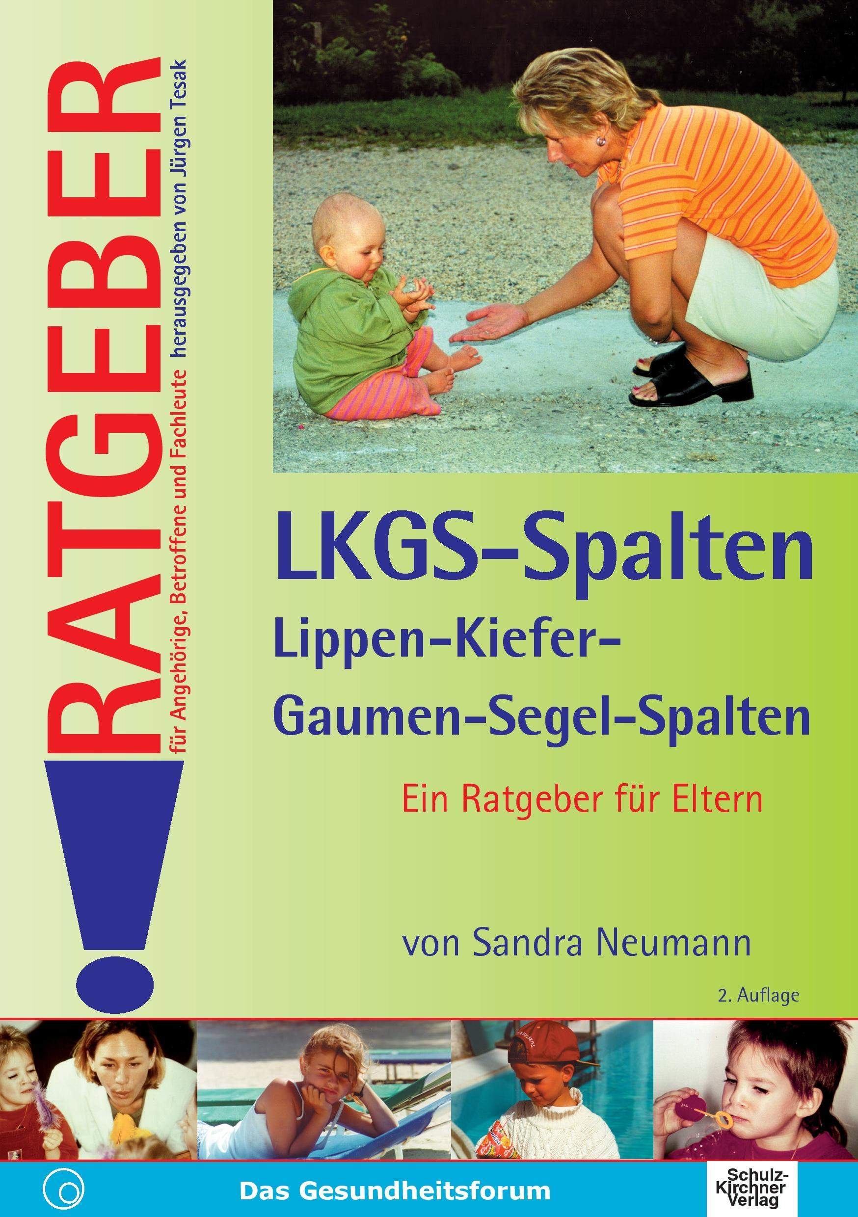 Cover: 9783824803651 | Lippen-Kiefer-Gaumen-Segelspalten (LKGS) | Ein Ratgeber für Eltern