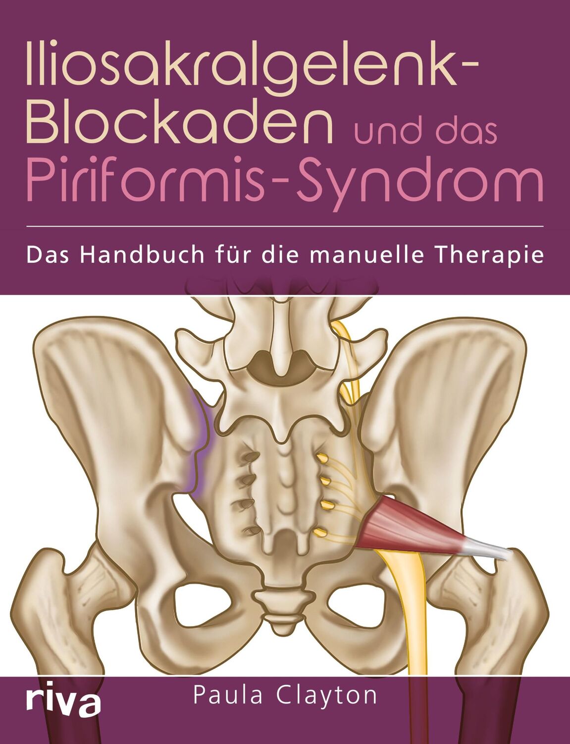 Cover: 9783742305015 | Iliosakralgelenk-Blockaden und das Piriformis-Syndrom | Paula Clayton