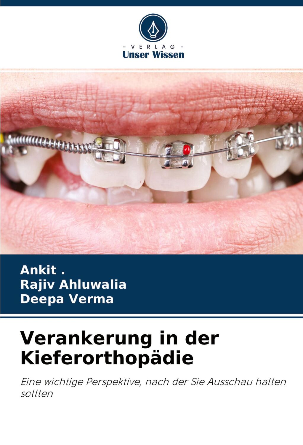 Cover: 9786204253183 | Verankerung in der Kieferorthopädie | Ankit (u. a.) | Taschenbuch