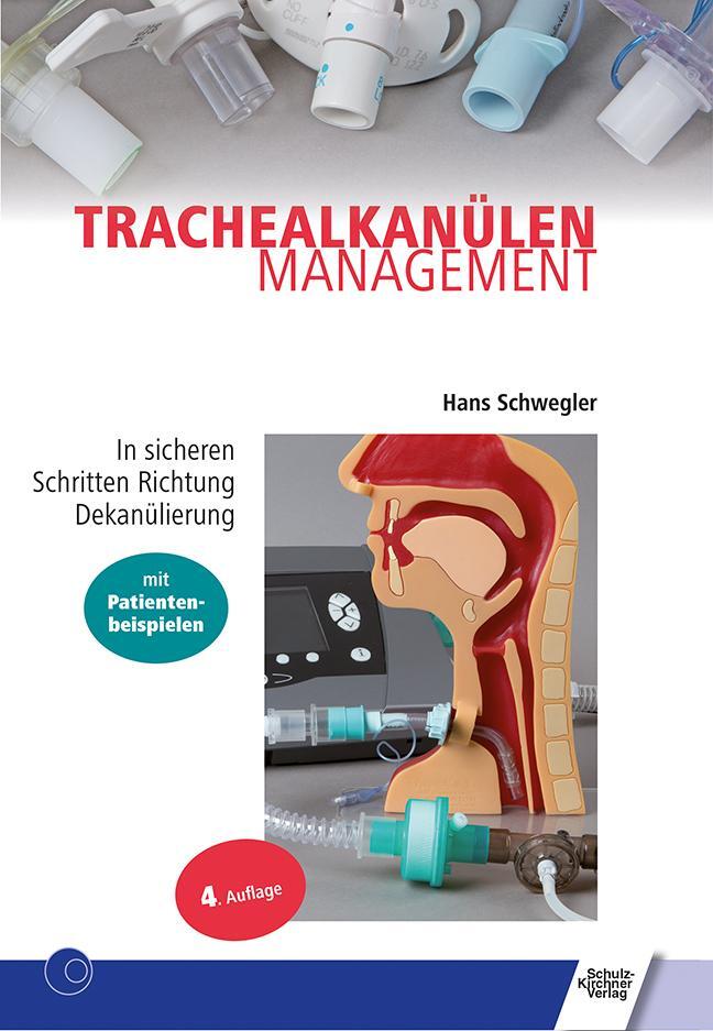 Cover: 9783824812608 | Trachealkanülenmanagement | Hans Schwegler | Taschenbuch | 208 S.