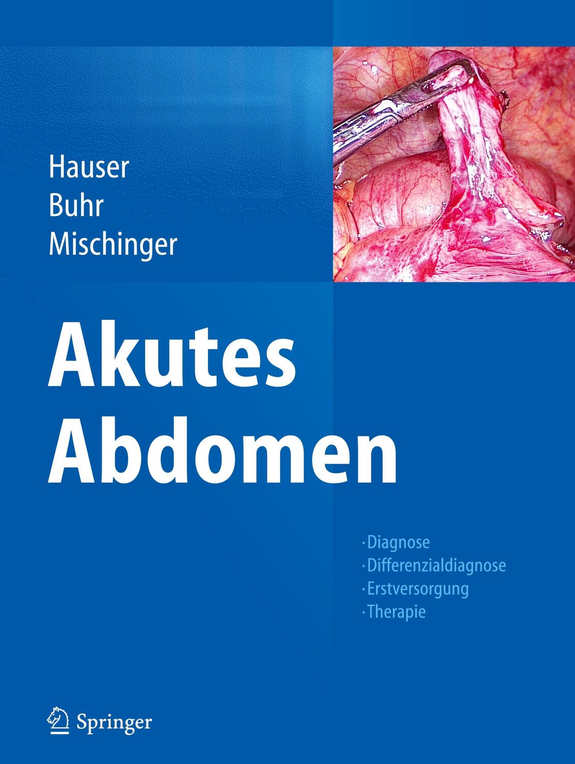 Cover: 9783709114728 | Akutes Abdomen | Hubert Hauser (u. a.) | Buch | xxx | Deutsch | 2016