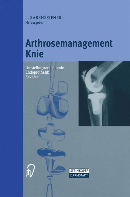 Cover: 9783642633355 | Arthrosemanagement Knie | L. Rabenseifner | Taschenbuch | Paperback